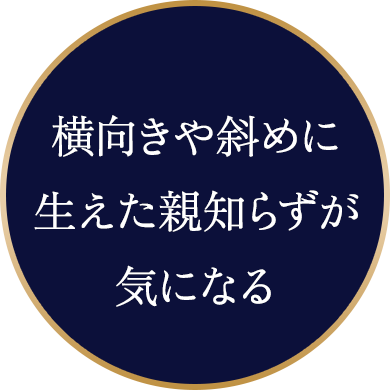 横向きや斜めに生えた親知らずが気になる